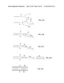 APPARATUS AND METHOD FOR INTRA-ABDOMINALLY MOVING A FIRST INTERNAL ORGAN     TO A POSITION AWAY FROM A SECOND INTERNAL ORGAN AND THEN HOLDING THE     FIRST INTERNAL ORGAN IN THE POSITION WITHOUT MANUAL INPUT diagram and image