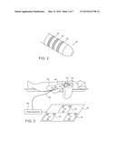 TRACKING OF CATHETER FROM INSERTION POINT TO HEART USING IMPEDANCE     MEASUREMENTS diagram and image