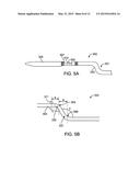 ATHERECTOMY CATHETERS WITH IMAGING diagram and image