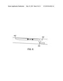 ATHERECTOMY CATHETERS WITH IMAGING diagram and image