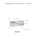 ATHERECTOMY CATHETERS WITH IMAGING diagram and image