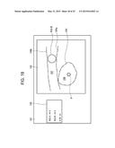 METHOD FOR SETTING REGIONS OF INTEREST AND ULTRASOUND DIAGNOSTIC APPARATUS diagram and image