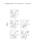 METHOD FOR SETTING REGIONS OF INTEREST AND ULTRASOUND DIAGNOSTIC APPARATUS diagram and image