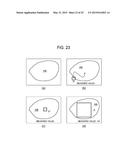 METHOD FOR SETTING REGIONS OF INTEREST AND ULTRASOUND DIAGNOSTIC APPARATUS diagram and image