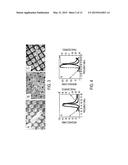 CATHETER DEVICE IMPLEMENTING HIGH FREQUENCY, CONTRAST IMAGING ULTRASOUND     TRANSDUCER, AND ASSOCIATED METHOD diagram and image