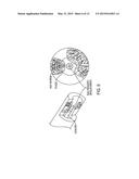 CATHETER DEVICE IMPLEMENTING HIGH FREQUENCY, CONTRAST IMAGING ULTRASOUND     TRANSDUCER, AND ASSOCIATED METHOD diagram and image