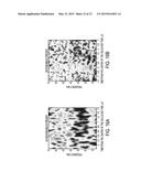 CATHETER DEVICE IMPLEMENTING HIGH FREQUENCY, CONTRAST IMAGING ULTRASOUND     TRANSDUCER, AND ASSOCIATED METHOD diagram and image