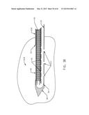 BIOPSY DEVICE WITH TRANSLATING VALVE MEMBER diagram and image