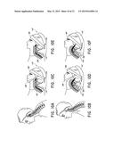 SYSTEMS AND METHODS FOR DECOMPRESSION AND ELLIPTICAL TRACTION OF THE     CERVICAL AND THORACIC SPINE diagram and image