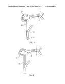 MEDICAL SYSTEM FOR ENDOVASCULAR TEMPERATURE CONTROL OF BLOOD, AND MEDICAL     CATHETER diagram and image