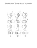 DEVICES AND METHODS FOR AIRWAY SUCTIONING diagram and image