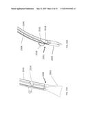 DEVICES AND METHODS FOR AIRWAY SUCTIONING diagram and image