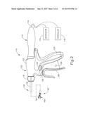 ULTRASONIC SURGICAL INSTRUMENT WITH ELECTROSURGICAL FEATURE diagram and image