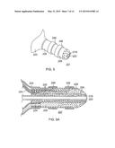 MULTI-ELECTRODE BALLOON CATHETER WITH CIRCUMFERENTIAL AND POINT ELECTRODES diagram and image