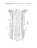 MULTI-ELECTRODE BALLOON CATHETER WITH CIRCUMFERENTIAL AND POINT ELECTRODES diagram and image