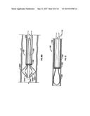 METHODS FOR TREATING A LUNG diagram and image