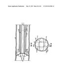 METHODS FOR TREATING A LUNG diagram and image