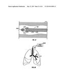 METHODS FOR TREATING A LUNG diagram and image