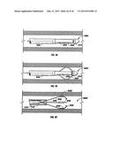 METHODS FOR TREATING A LUNG diagram and image