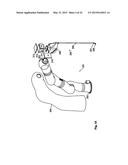 Robotic Surgery System diagram and image