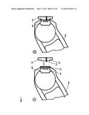 Robotic Surgery System diagram and image