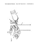 Robotic Surgery System diagram and image