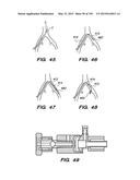 SYSTEMS AND METHODS FOR POSITIONING AN ELONGATE MEMBER INSIDE A BODY diagram and image