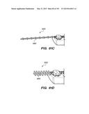 SYSTEMS AND METHODS FOR POSITIONING AN ELONGATE MEMBER INSIDE A BODY diagram and image