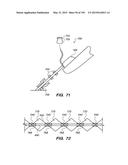 SYSTEMS AND METHODS FOR POSITIONING AN ELONGATE MEMBER INSIDE A BODY diagram and image