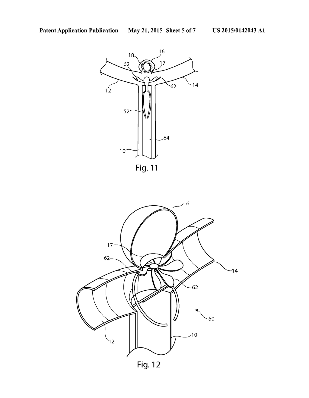 ANEURYSM CLOSURE DEVICE - diagram, schematic, and image 06