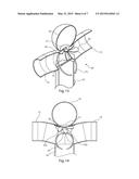 ANEURYSM CLOSURE DEVICE diagram and image