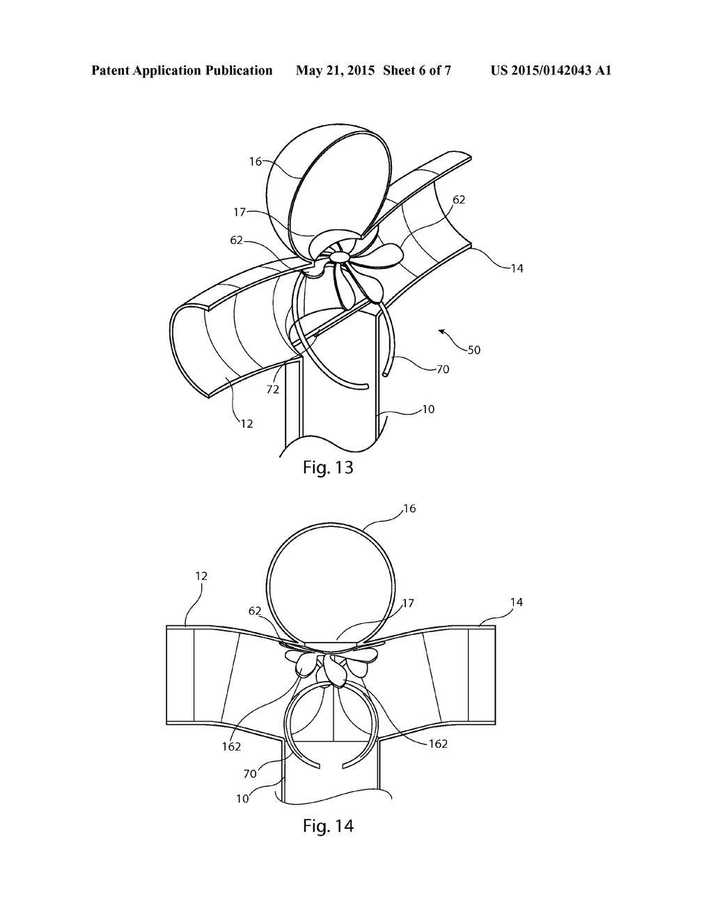 ANEURYSM CLOSURE DEVICE - diagram, schematic, and image 07