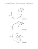 APPARATUS AND METHODS FOR ACCESSING AND SEALING BODILY VESSELS AND     CAVITIES diagram and image