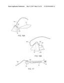 APPARATUS AND METHODS FOR ACCESSING AND SEALING BODILY VESSELS AND     CAVITIES diagram and image