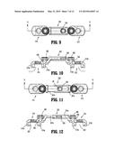 TRANSVERSE ROD CONNECTOR diagram and image