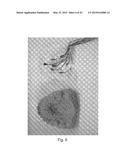 HYBRID METHOD FOR MODULATING UPPER AIRWAY FUNCTION IN A SUBJECT diagram and image