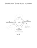 HYBRID METHOD FOR MODULATING UPPER AIRWAY FUNCTION IN A SUBJECT diagram and image