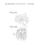 ACCELERATING METHOD, OPTOMEDICAL DEVICE, AND OPTOMEDICAL SYSTEM diagram and image