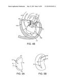 PROSTHETIC HEART VALVE DEVICES, PROSTHETIC MITRAL VALVES AND ASSOCIATED     SYSTEMS AND METHODS diagram and image