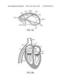 PROSTHETIC HEART VALVE DEVICES, PROSTHETIC MITRAL VALVES AND ASSOCIATED     SYSTEMS AND METHODS diagram and image