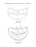 PROSTHETIC HEART VALVE DEVICES, PROSTHETIC MITRAL VALVES AND ASSOCIATED     SYSTEMS AND METHODS diagram and image