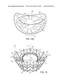 PROSTHETIC HEART VALVE DEVICES, PROSTHETIC MITRAL VALVES AND ASSOCIATED     SYSTEMS AND METHODS diagram and image