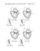 PROSTHETIC HEART VALVE DEVICES, PROSTHETIC MITRAL VALVES AND ASSOCIATED     SYSTEMS AND METHODS diagram and image