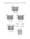 PROSTHETIC HEART VALVE DEVICES, PROSTHETIC MITRAL VALVES AND ASSOCIATED     SYSTEMS AND METHODS diagram and image