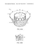 PROSTHETIC HEART VALVE DEVICES, PROSTHETIC MITRAL VALVES AND ASSOCIATED     SYSTEMS AND METHODS diagram and image