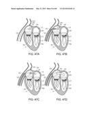 PROSTHETIC HEART VALVE DEVICES, PROSTHETIC MITRAL VALVES AND ASSOCIATED     SYSTEMS AND METHODS diagram and image