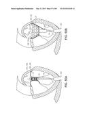 PROSTHETIC HEART VALVE DEVICES, PROSTHETIC MITRAL VALVES AND ASSOCIATED     SYSTEMS AND METHODS diagram and image