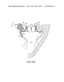 PROSTHETIC HEART VALVE DEVICES, PROSTHETIC MITRAL VALVES AND ASSOCIATED     SYSTEMS AND METHODS diagram and image