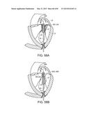 PROSTHETIC HEART VALVE DEVICES, PROSTHETIC MITRAL VALVES AND ASSOCIATED     SYSTEMS AND METHODS diagram and image