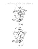 PROSTHETIC HEART VALVE DEVICES, PROSTHETIC MITRAL VALVES AND ASSOCIATED     SYSTEMS AND METHODS diagram and image